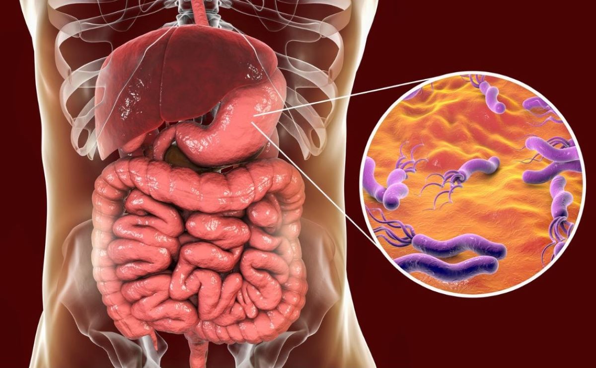 Helicobacter pylori